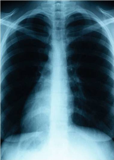 What are some symptoms that you need to see a lung specialist?